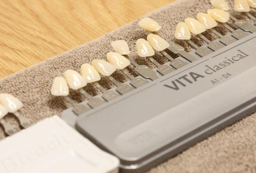 審美治療・ホワイトニング