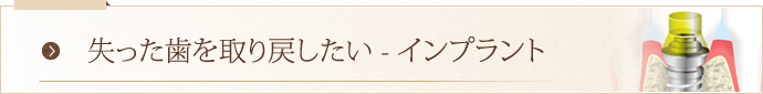 失った歯を取り戻したい – インプラント