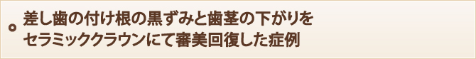 差し歯の付け根の黒ずみと歯茎の下がりを セラミッククラウンにて審美回復した症例