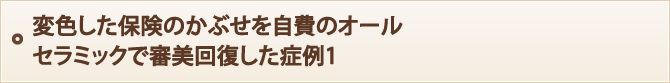 変色した保険のかぶせを自費のオールセラミックで審美回復した症例1