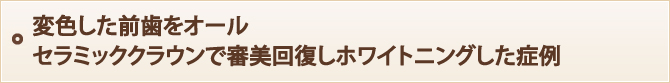 変色した前歯をオールセラミッククラウンで審美回復しホワイトニングした症例