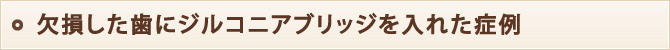欠損した歯にジルコニアブリッジを入れた症例